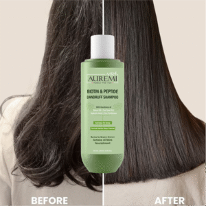 Watch Replaced Image